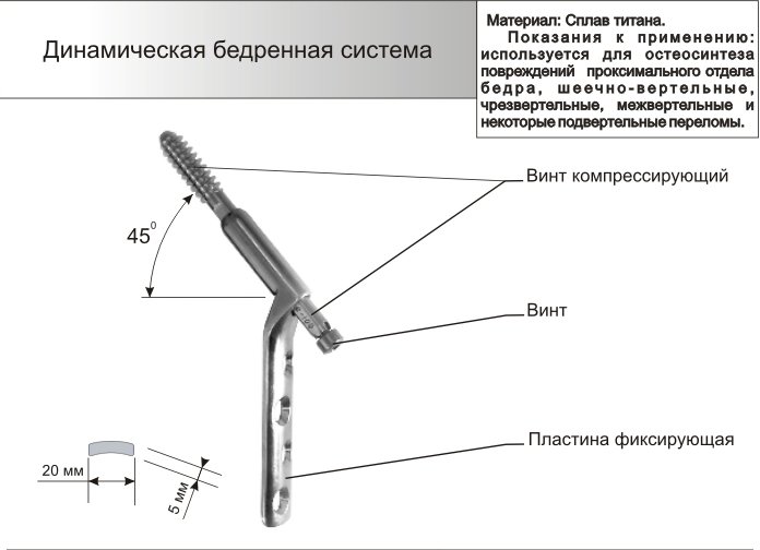 Динамическая бедренная система в сборке