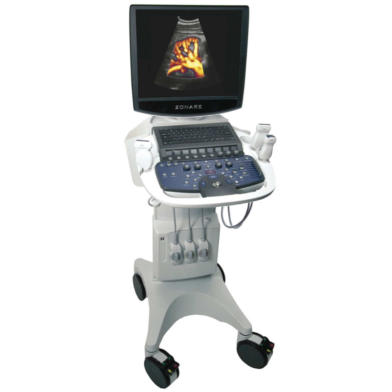 Mindray ZS3