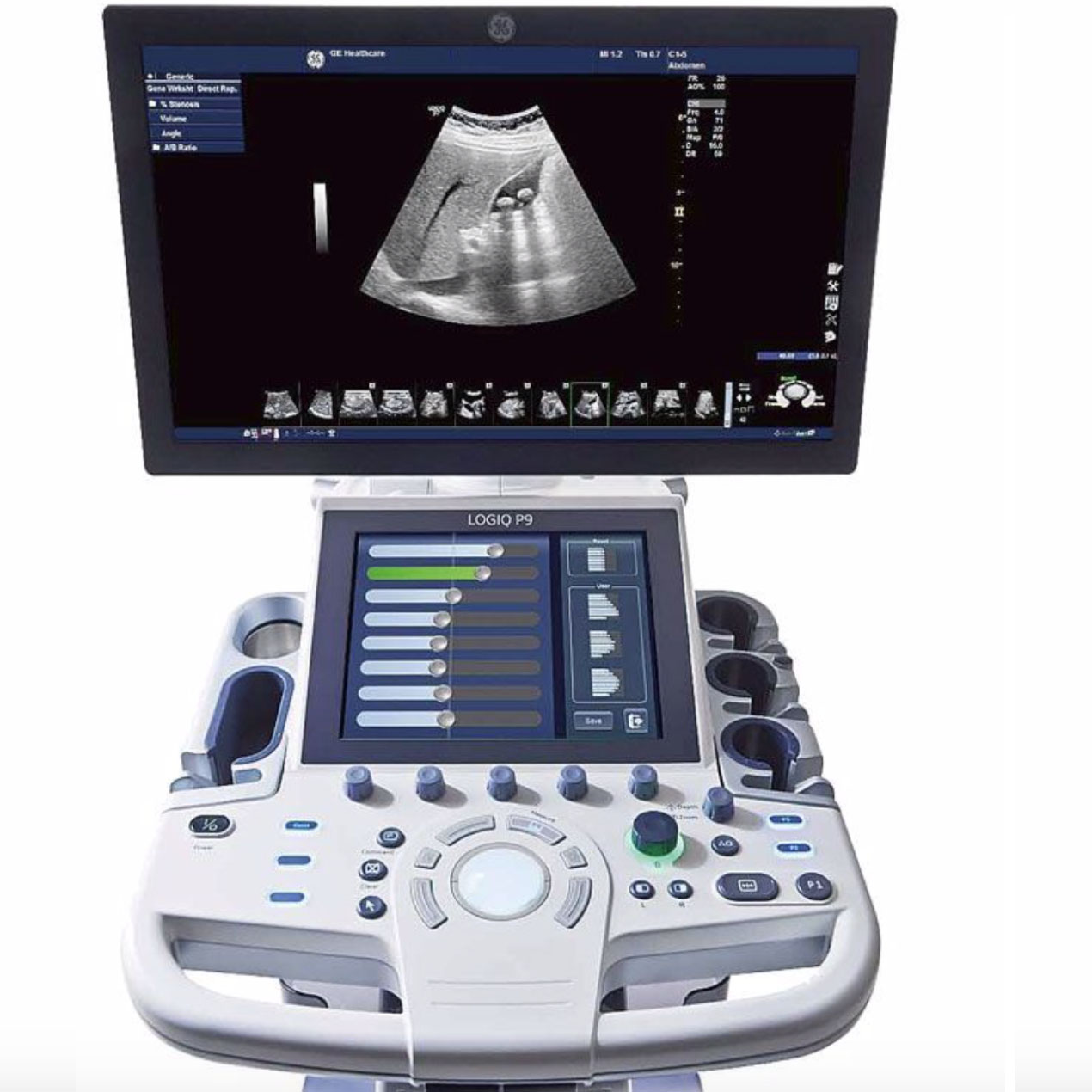 GE Logiq P9