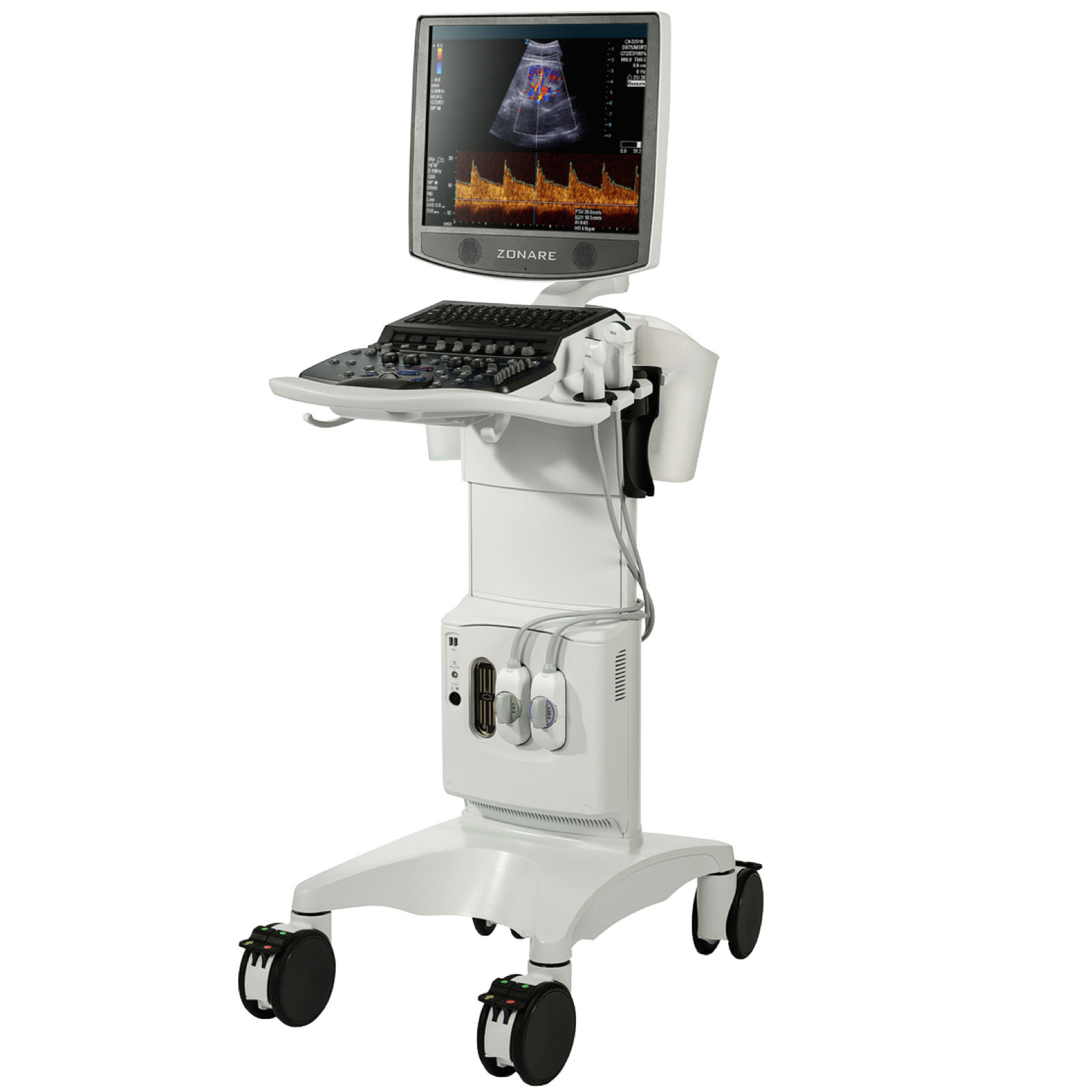 Mindray ZS3