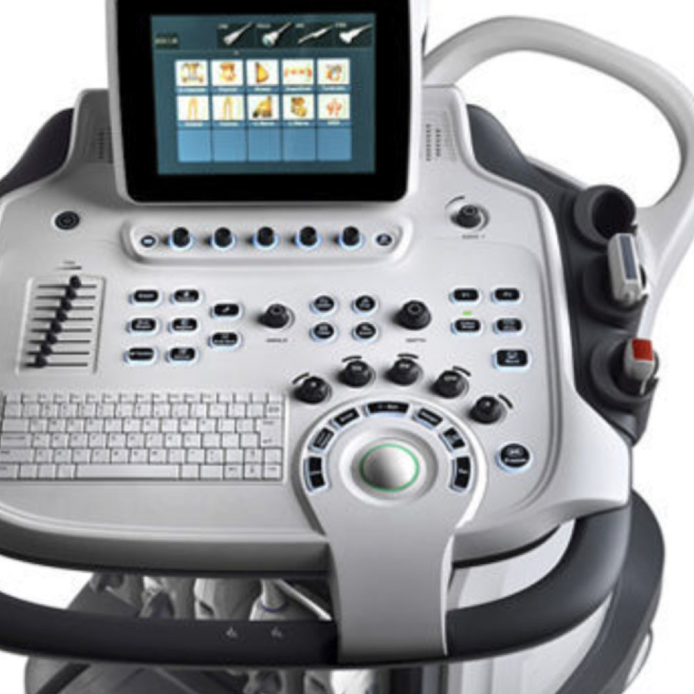 Sonoscape S35