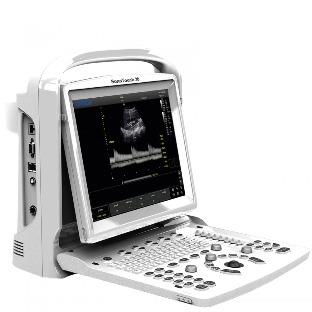 Chison SonoTouch 20 (ST20)