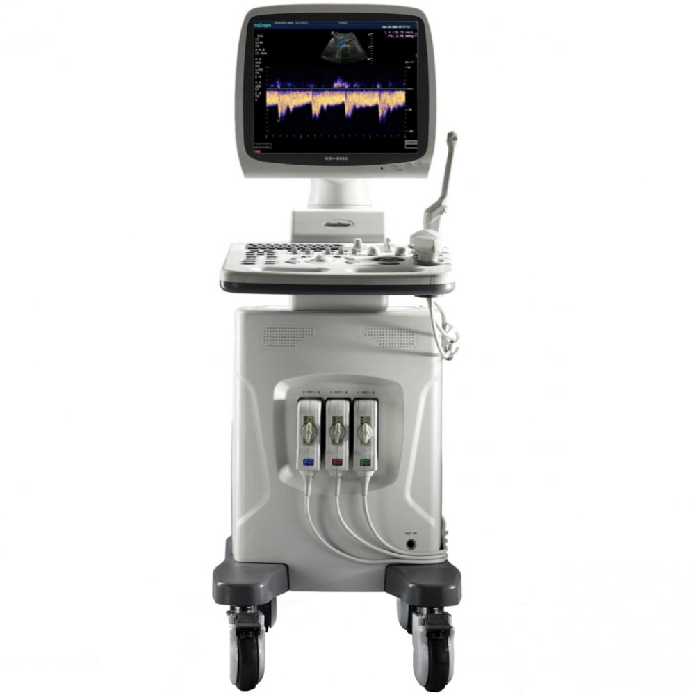 Sonoscape SSI-6000