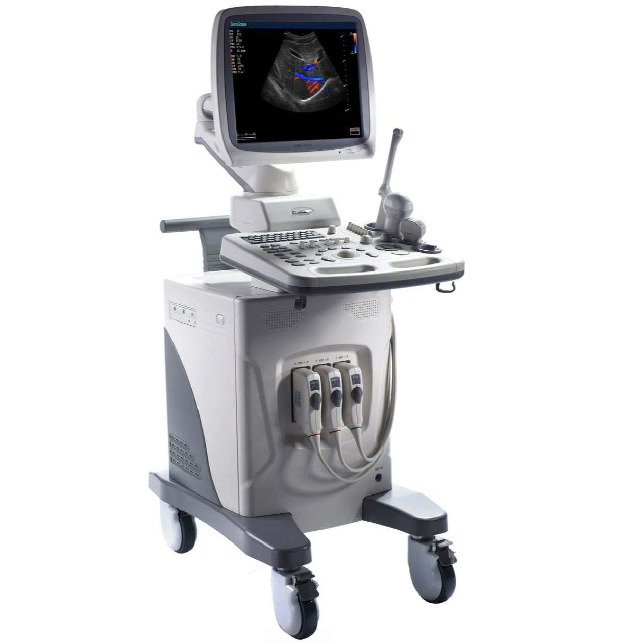 Sonoscape SSI-6000