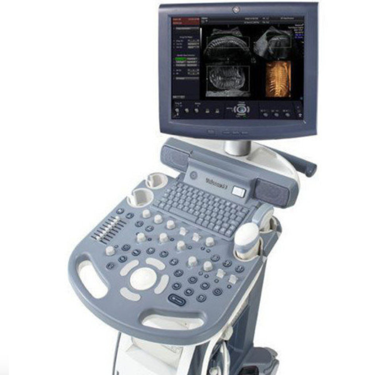GE Voluson S8