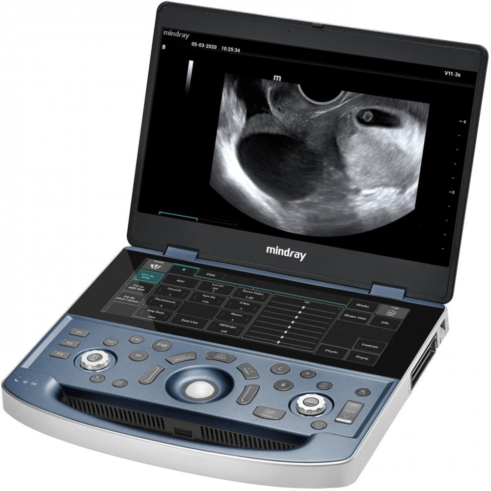 Mindray MX8