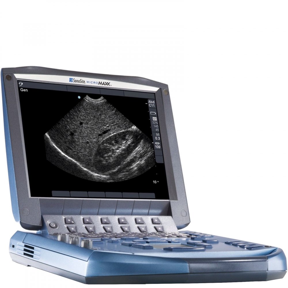 Fujifilm Sonosite micromaxx