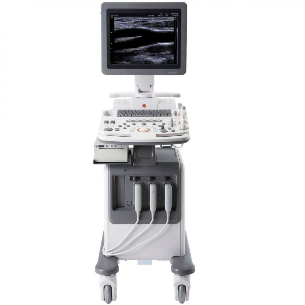 Samsung Medison SonoAce R5