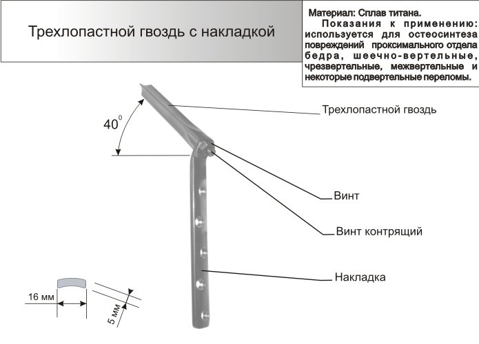 Трехлопастной гвоздь с накладкой в сборке