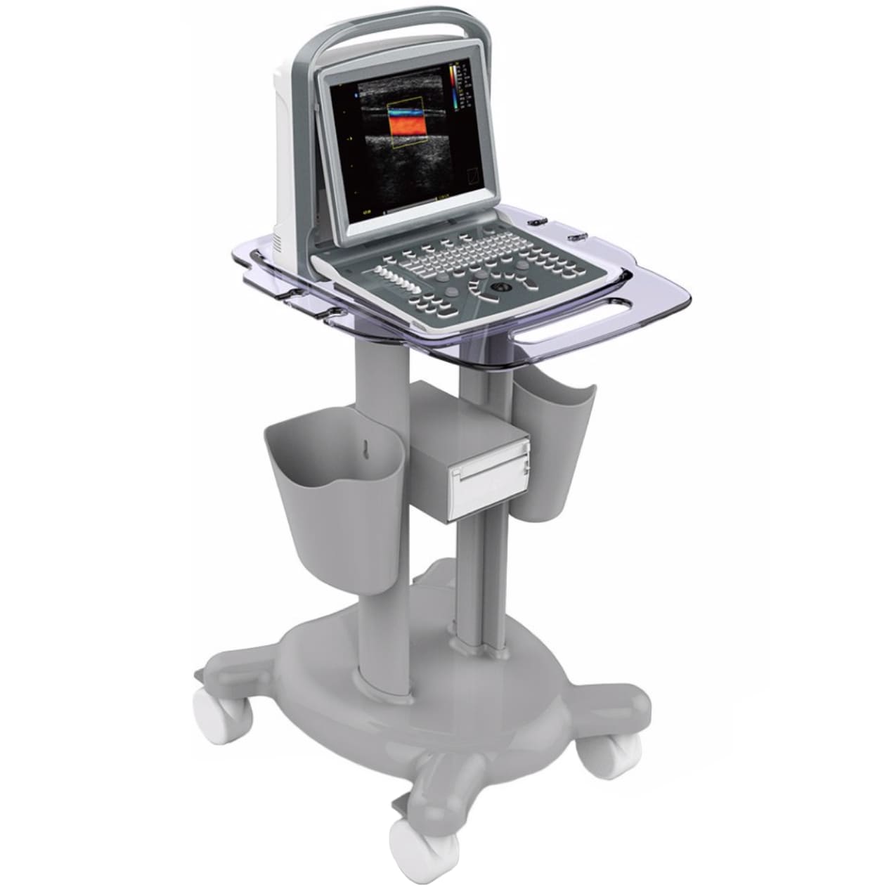 Chison SonoTouch 20 (ST20)