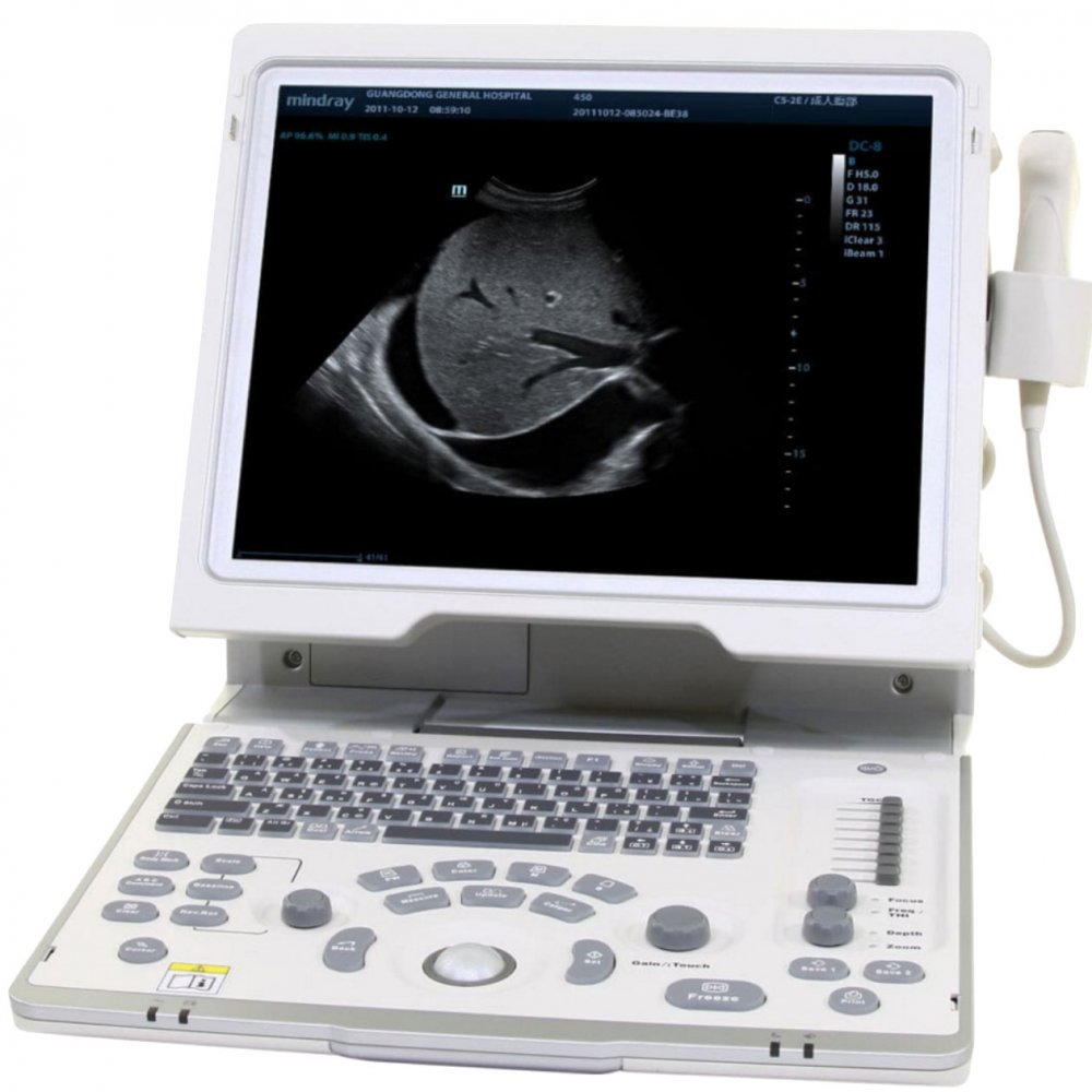 Mindray DP-50