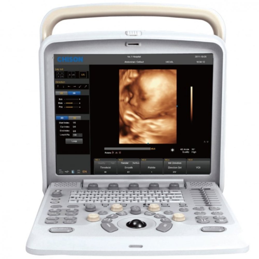 Chison SonoTouch-50 (ST 50), (Ebit50),(ECO6)