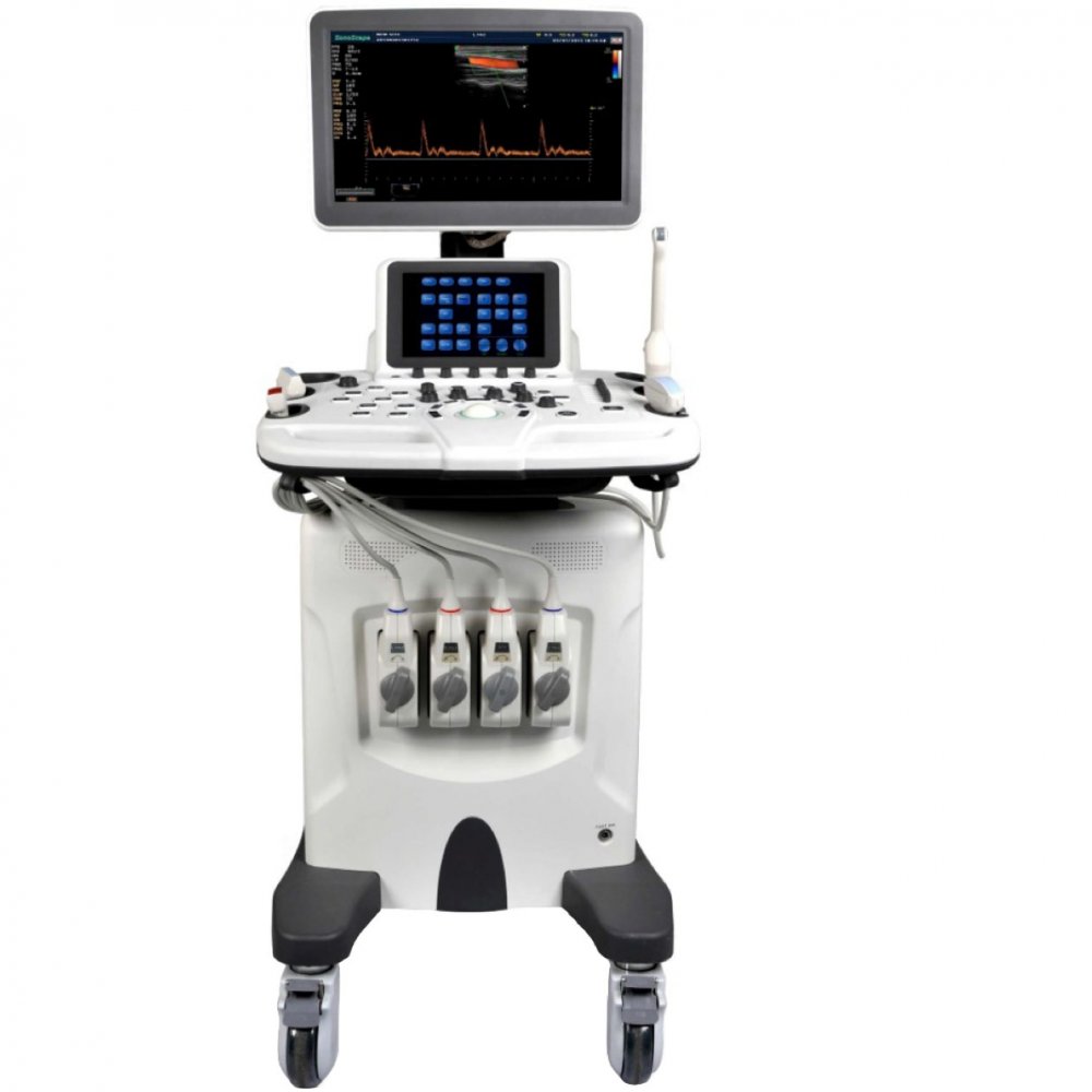 Sonoscape S30