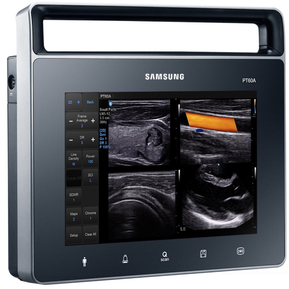 Samsung Medison PT60A