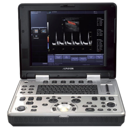 Alpinion E-Cube Inno