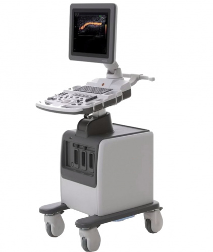 Samsung Medison SonoAce R5
