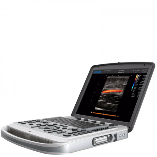 Chison SonoBook 8
