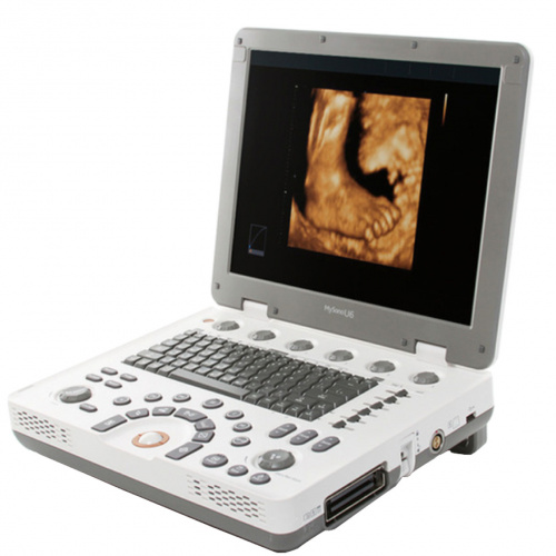 Samsung Medison MySono U6