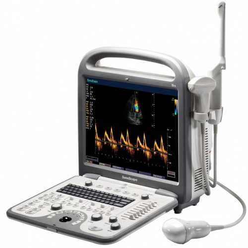 Sonoscape S8