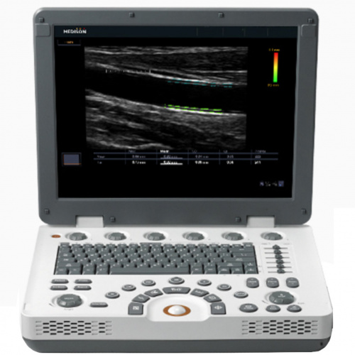 Samsung Medison MySono U6