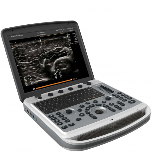 Chison SonoBook 8