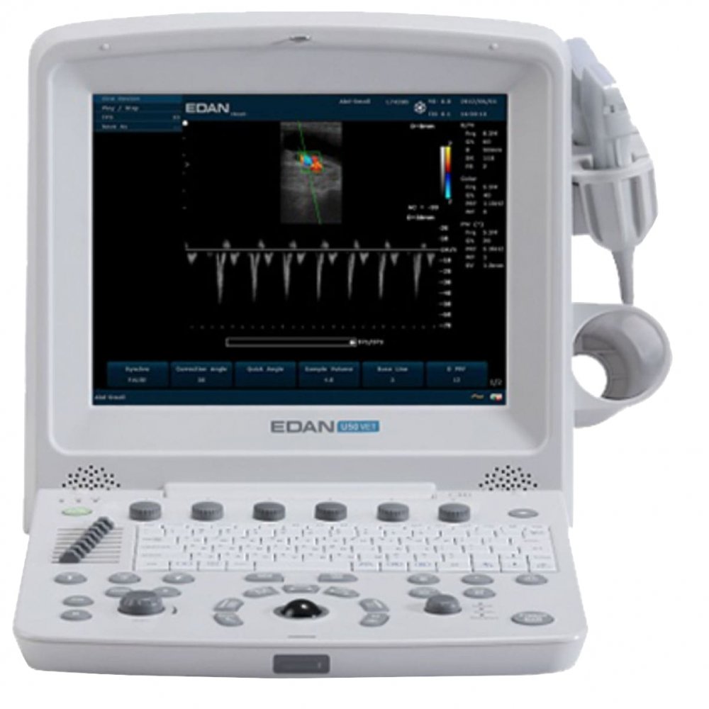 Edan U50