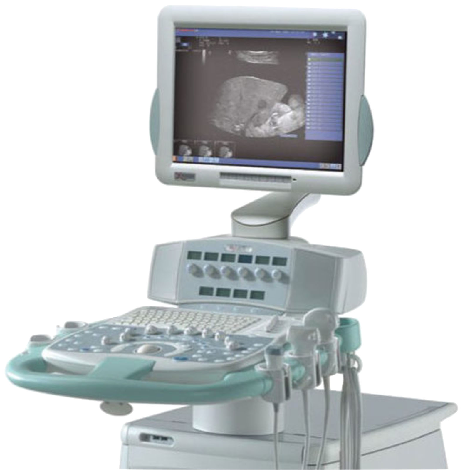 Esaote MyLab 60