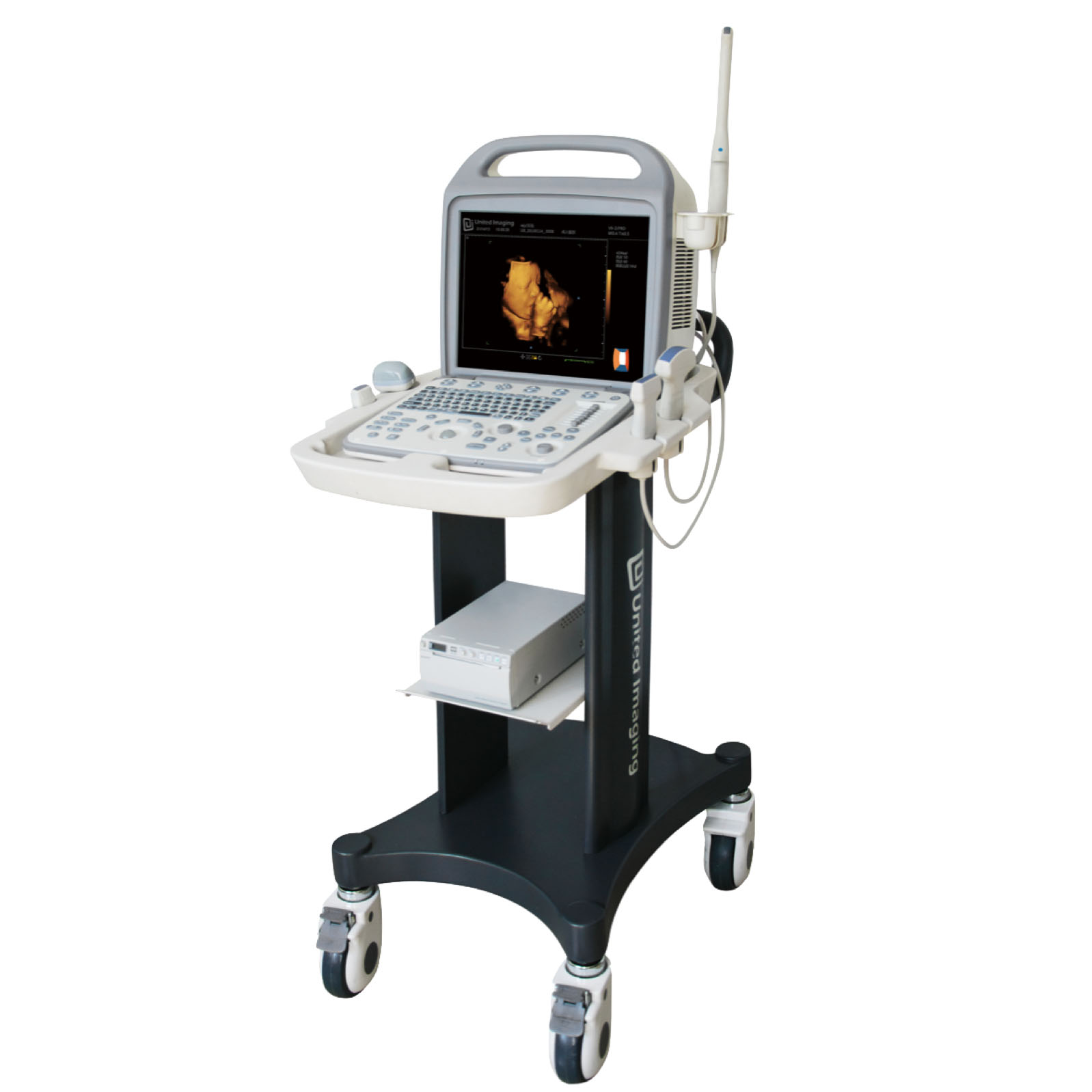 United Imaging iuStar 160