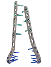 Пластины Vortex Distal Humerus