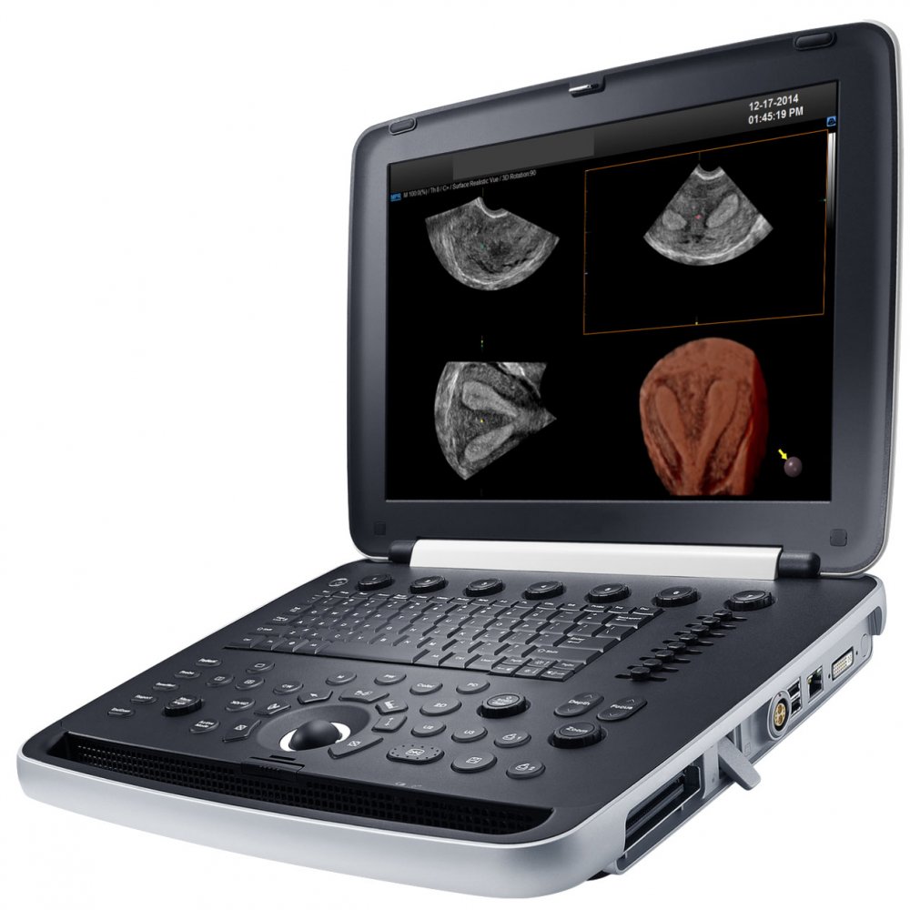 Samsung Medison HM70 EVO