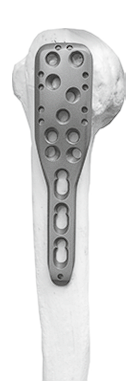 Пластина Т-образная для плечевой кости	LCP Humeral Neck T-Plate 11,0х4,0 mm с у/с с о/к 11,0х4,0 мм