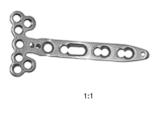 Пластина для лучевой кости (ЛТм) LCP Plate Radial Bone (LTM) 6,5x2,0 mm с у/с 6,5х2,0 мм