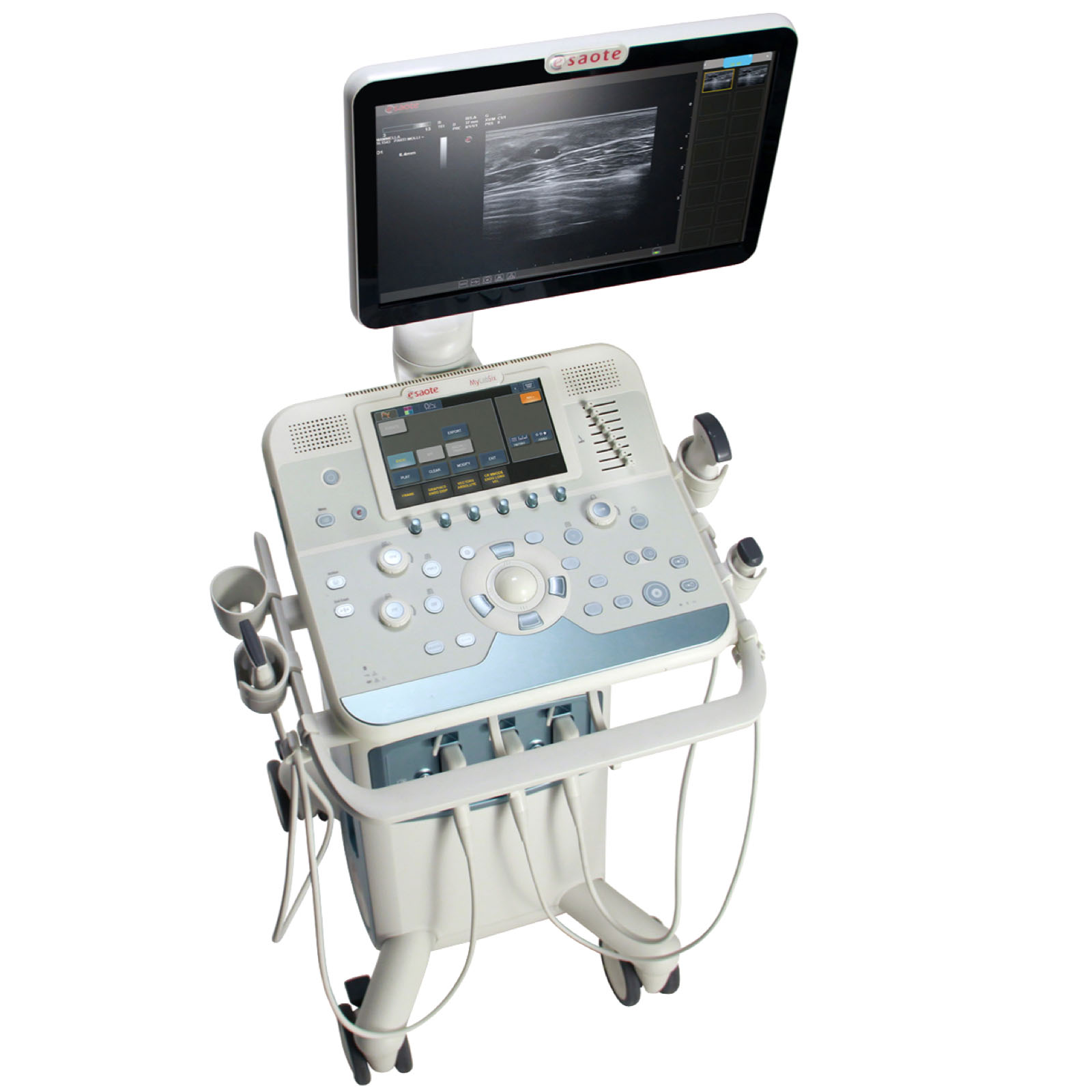 Esaote MyLab X5