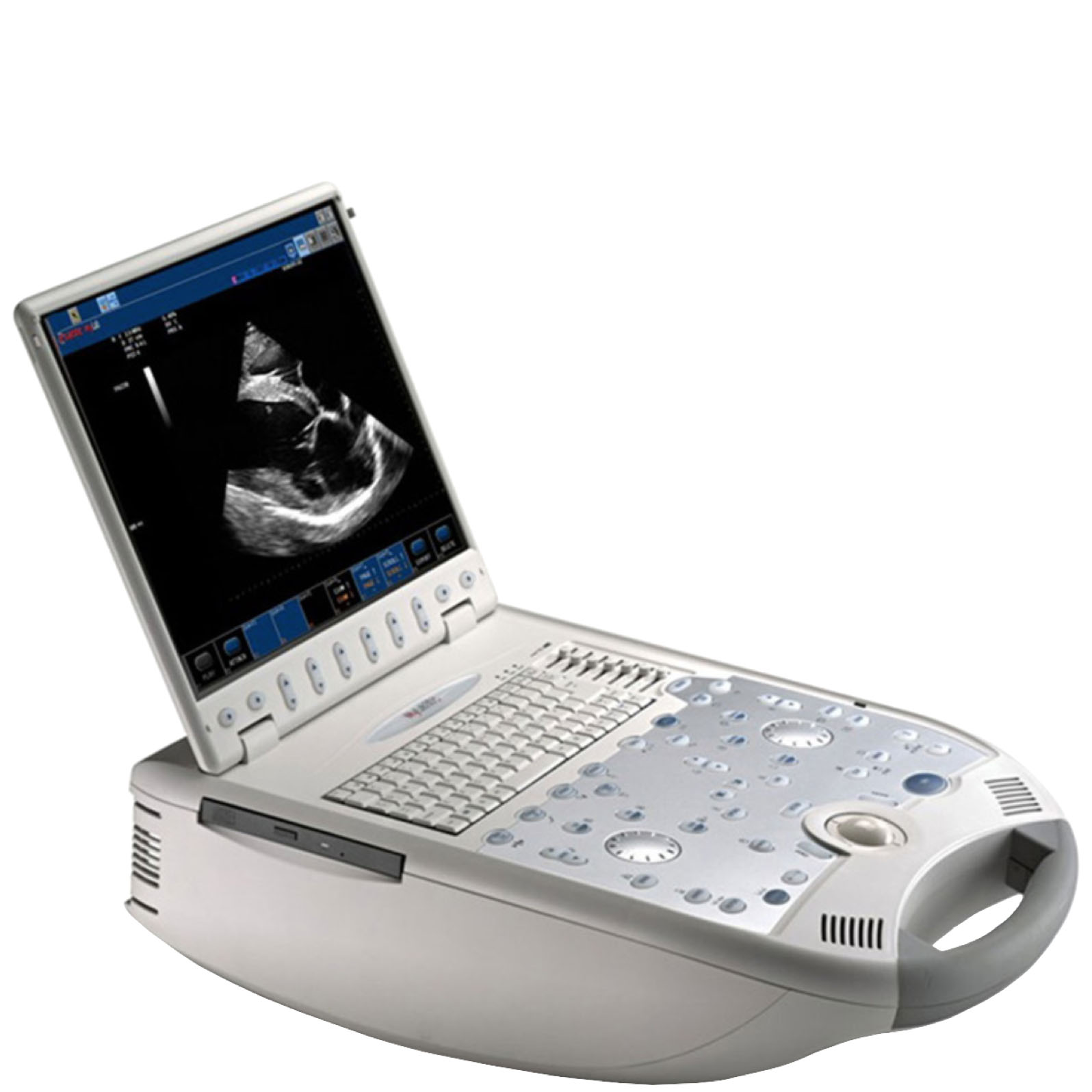 Esaote MyLab 25