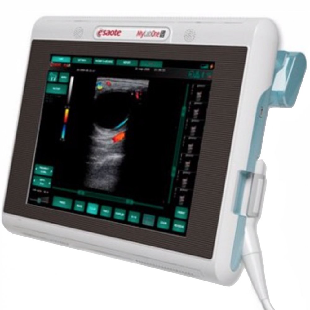 Esaote MyLab One Touch