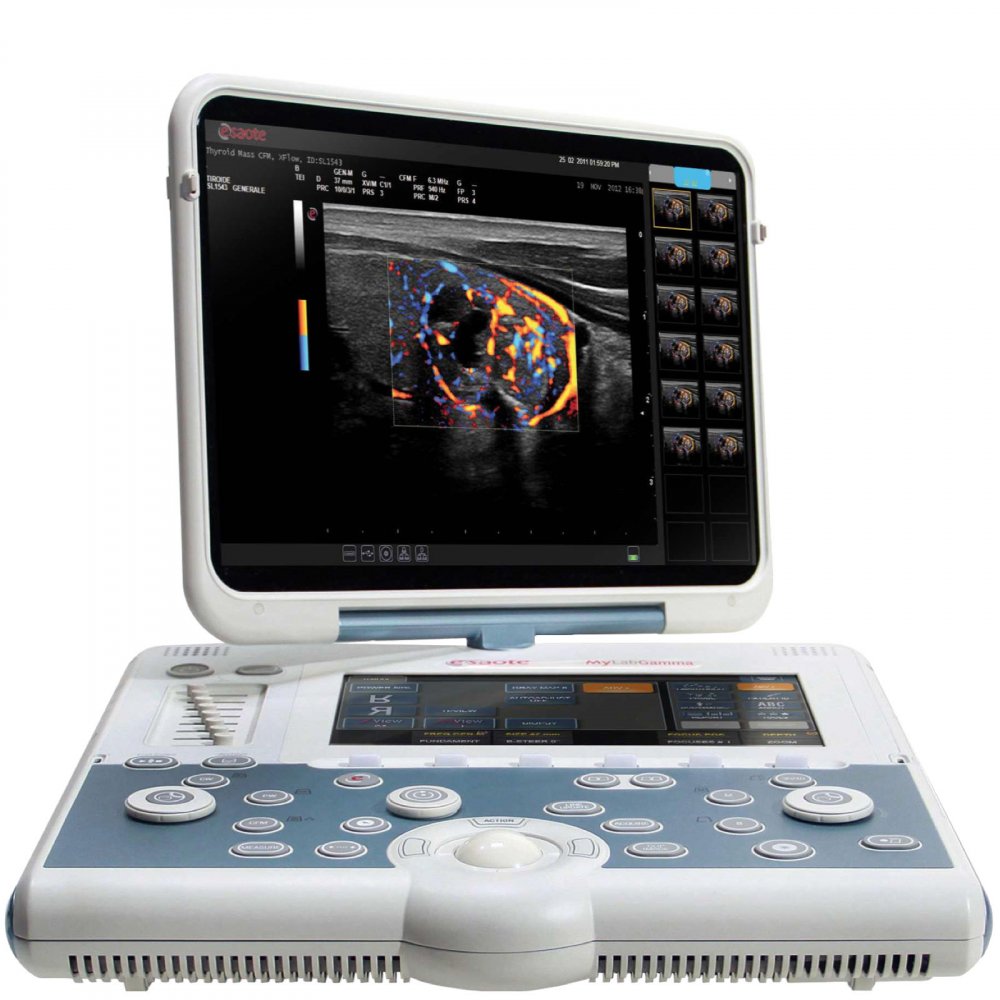 Esaote MyLab Omega