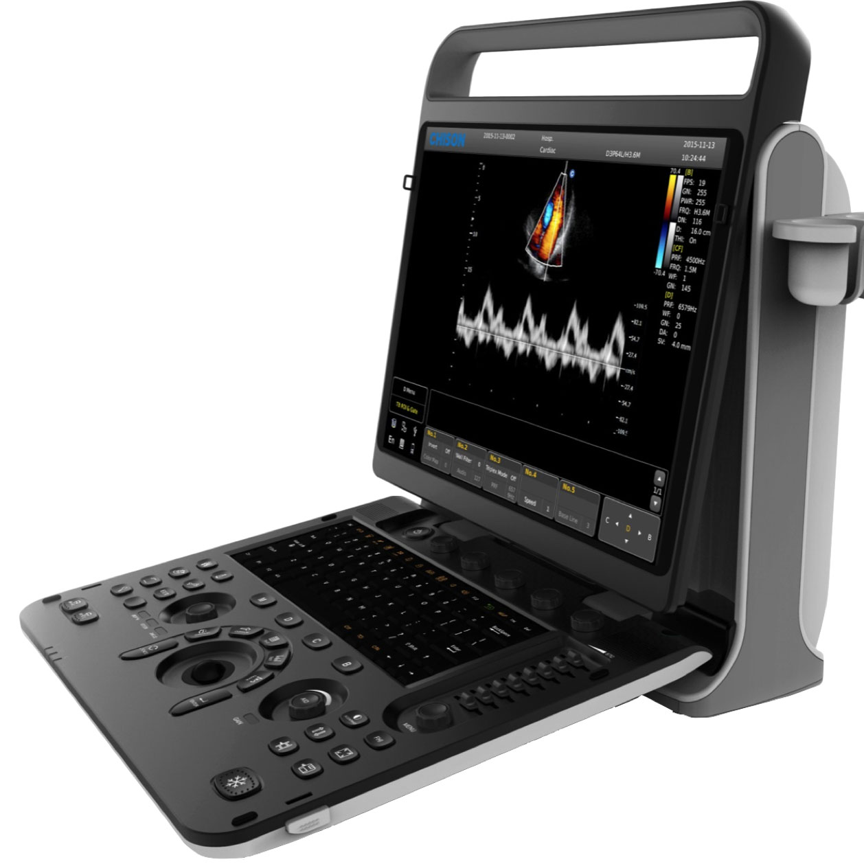 Chison SonoTouch 30 (ST30)