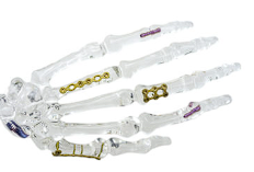 Пластины Vortex Hand & Foot