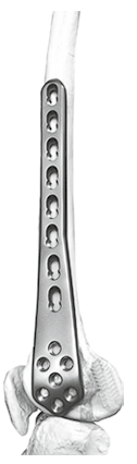 Пластина опорная мыщелковая с у/с 18,0х7,0 мм	LCP Condylar Plate 18,0х7,0 mm