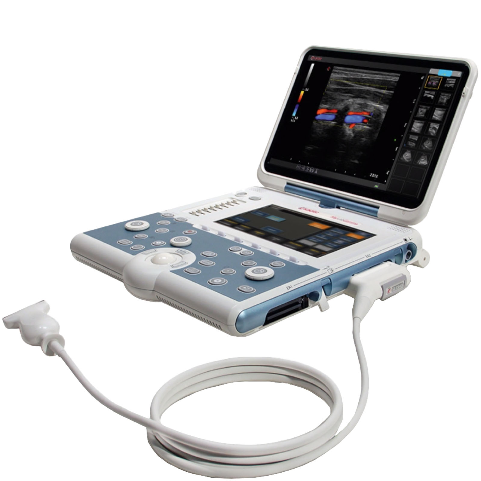 Esaote MyLab Omega