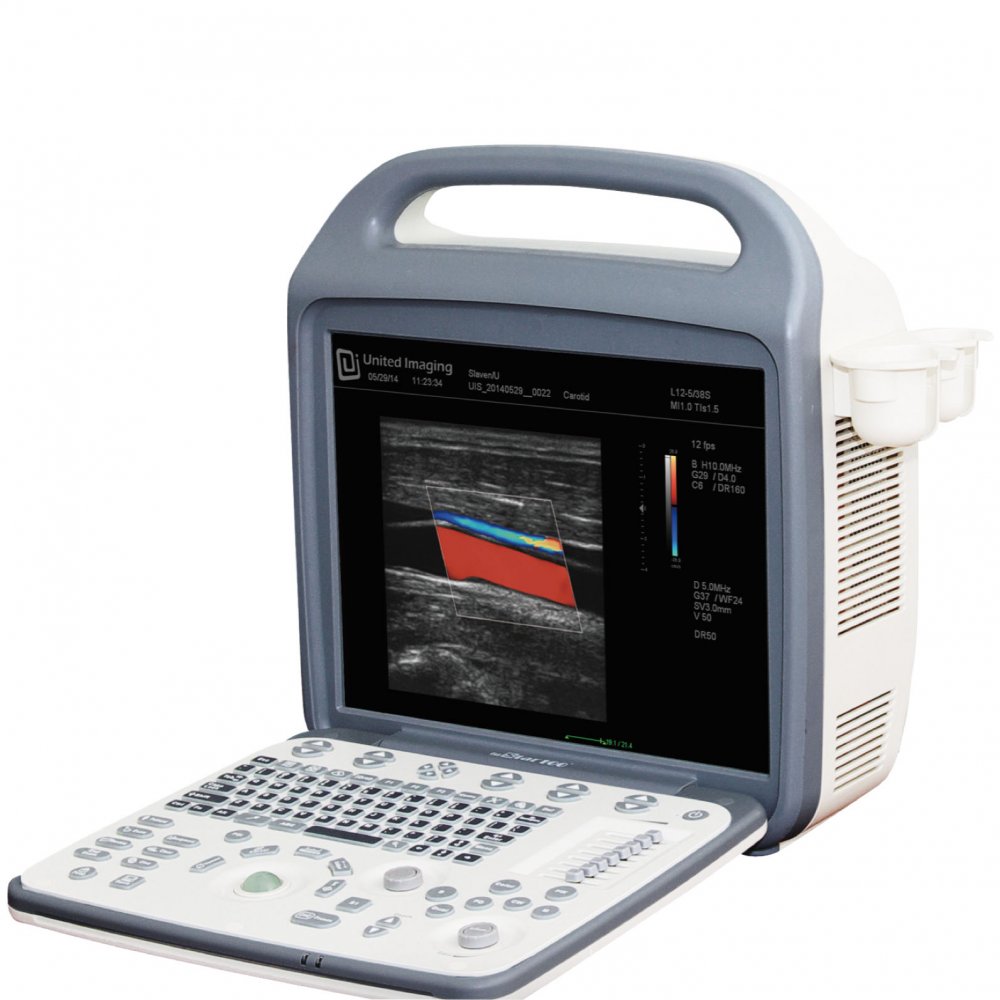 United Imaging iuStar 160