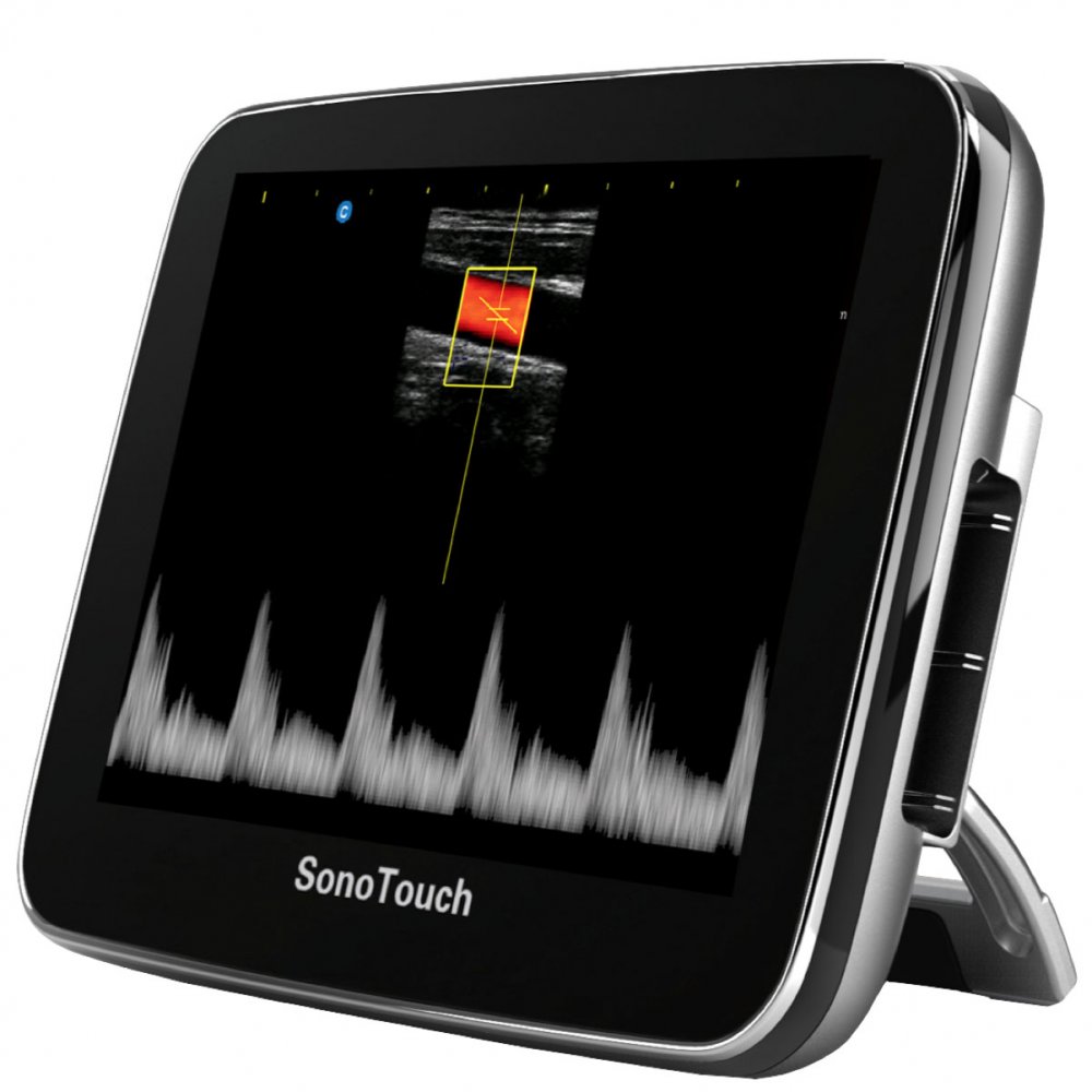 Chison SonoTouch 10 (ST10)