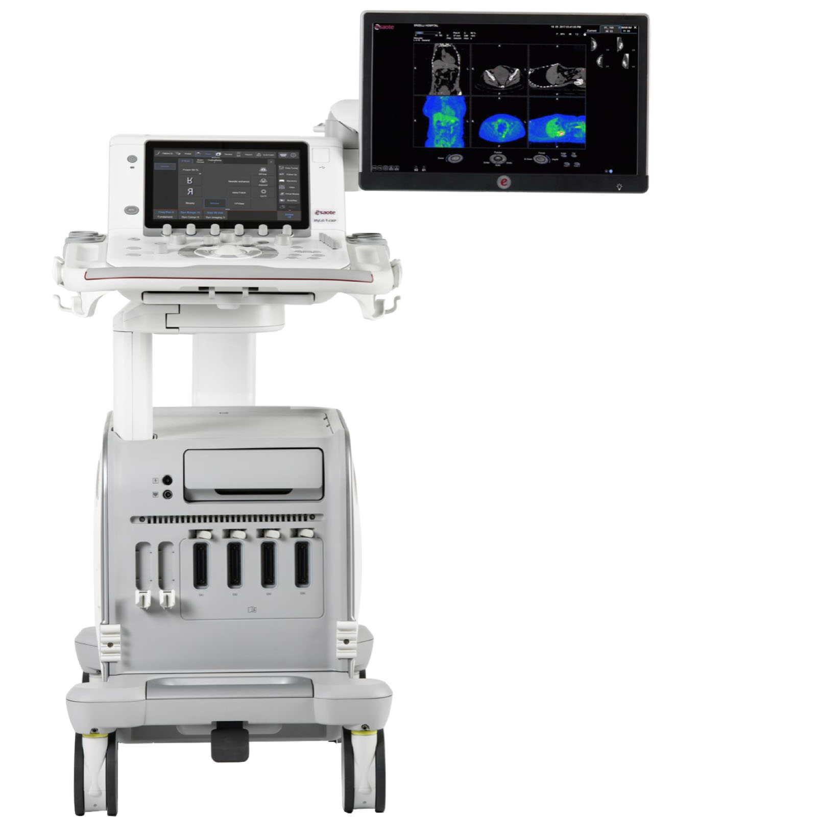 Esaote Mylab 9
