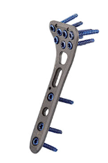 Пластина Vortex Distal Radius