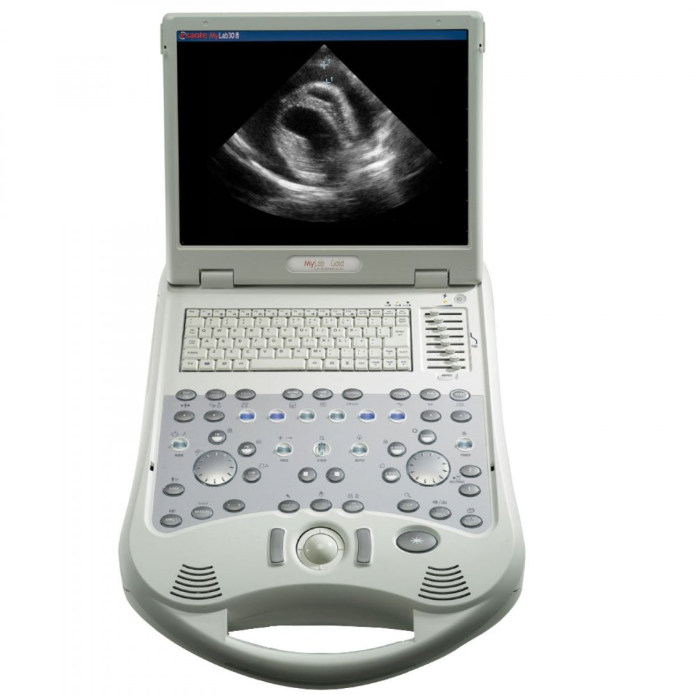 Esaote MyLab 25