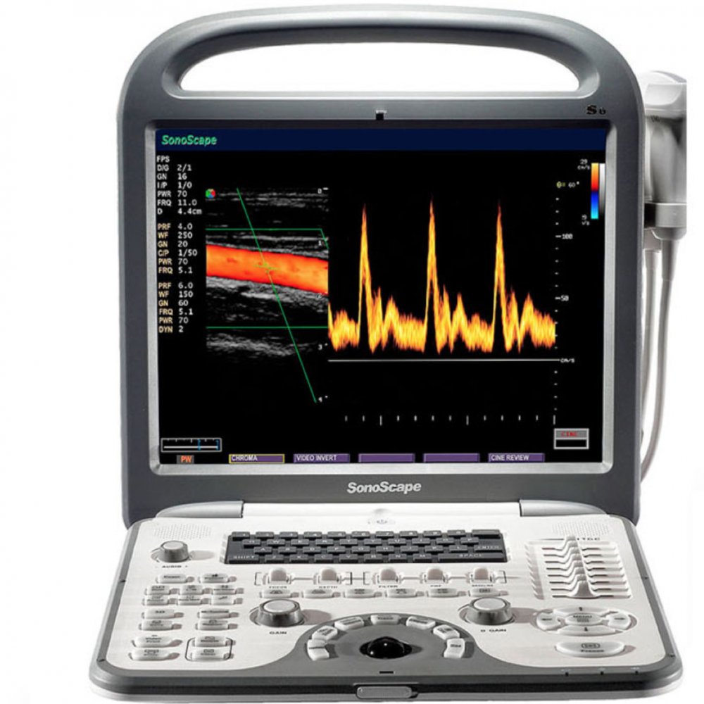 Sonoscape S6N VET