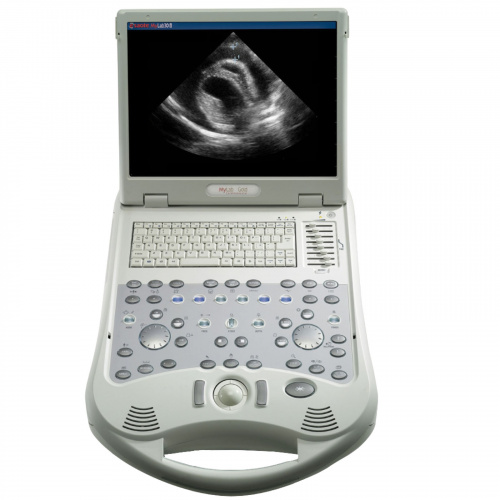 Esaote MyLab 25