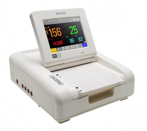 Philips AVALON FM20