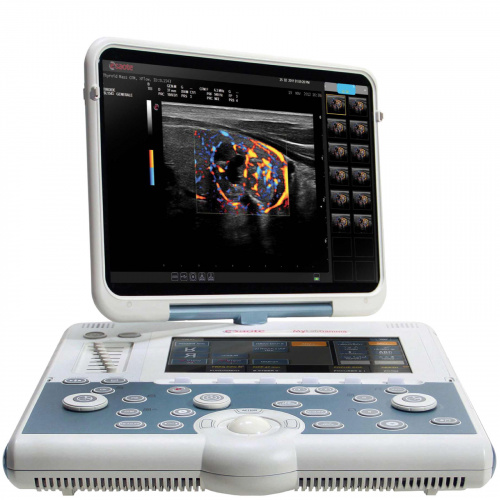 Esaote MyLab Omega