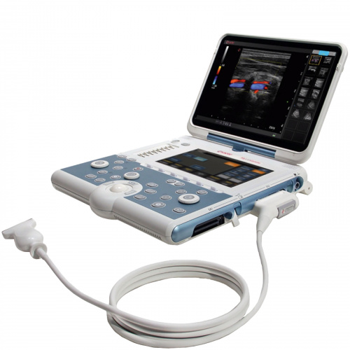 Esaote MyLab Omega